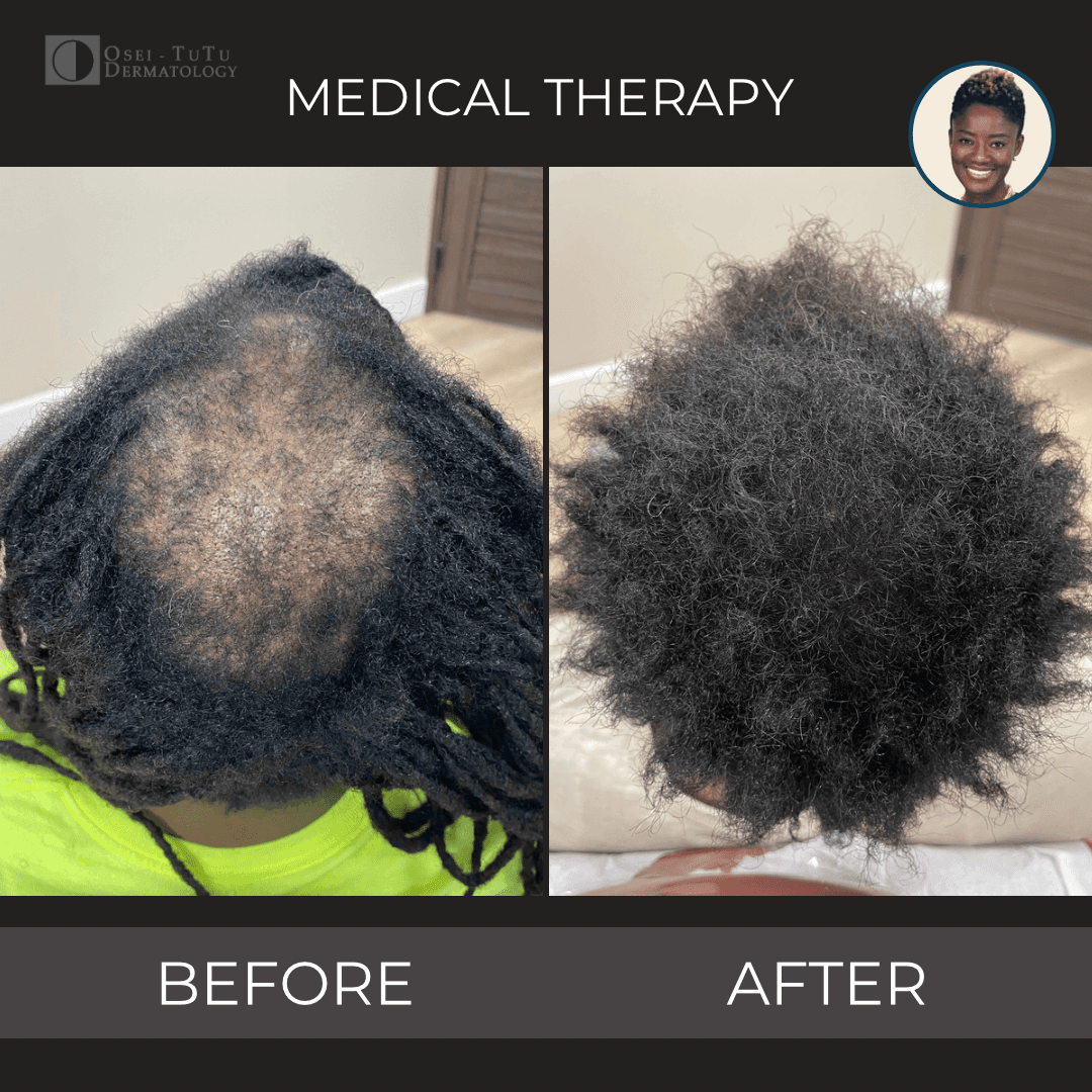 Osei-Tutu Dermatology & Hair Restoration